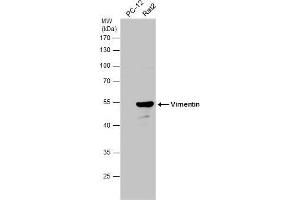 WB Image Various whole cell extracts (30 μg) were separated by 10% SDS-PAGE, and the membrane was blotted with Vimentin antibody , diluted at 1:10000. (Vimentin 抗体)