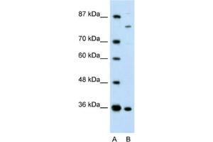 Western Blotting (WB) image for anti-Ankyrin Repeat and Zinc Finger Domain Containing 1 (ANKZF1) antibody (ABIN2461250) (ANKZF1 抗体)
