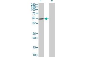 Western Blot analysis of PRKX expression in transfected 293T cell line by PRKX MaxPab polyclonal antibody. (PRKX 抗体  (AA 1-358))