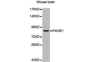 Western Blotting (WB) image for anti-Phosphoinositide 3 Kinase, p85 alpha (PI3K p85a) (AA 1-300) antibody (ABIN3020625) (PIK3R1 抗体  (AA 1-300))