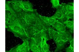 Immunofluorescence (fixed cells) (IF/ICC) image for anti-Glutamate Receptor, Ionotropic, N-Methyl D-Aspartate 2B (GRIN2B) (AA 20-271) antibody (PE) (ABIN2483221)