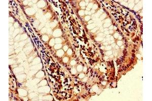 Immunohistochemistry (IHC) image for anti-Tumor Necrosis Factor (Ligand) Superfamily, Member 11 (TNFSF11) (AA 73-306) antibody (ABIN7173790)