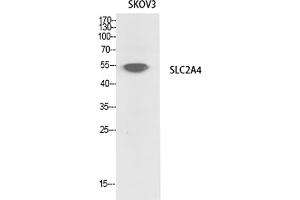 Western Blot analysis of SKOV3 cells using Glut4 Polyclonal Antibody. (GLUT4 抗体  (N-Term))