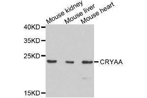 Western blot analysis of extracts of various cell lines, using CRYAA antibody. (CRYAA 抗体  (AA 1-173))