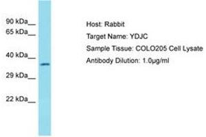 Image no. 1 for anti-YdjC Homolog (YdjC) (AA 217-266) antibody (ABIN6750767) (YdjC 抗体  (AA 217-266))