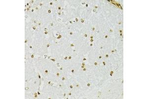 Immunohistochemistry of paraffin-embedded mouse brain using ADAR antibody (ABIN5975213) at dilution of 1/100 (40x lens). (ADAR 抗体)