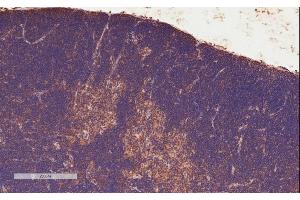 Immunohistochemistry (IHC) image for anti-Signal Transducer and Activator of Transcription 3 (Acute-Phase Response Factor) (STAT3) (C-Term) antibody (ABIN184593)
