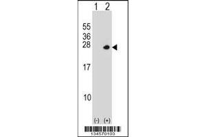 Western Blotting (WB) image for anti-Proteasome (Prosome, Macropain) 26S Subunit, Non-ATPase, 10 (PSMD10) (AA 184-213), (C-Term) antibody (ABIN5536457)
