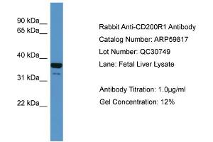 WB Suggested Anti-CD200R1  Antibody Titration: 0. (CD200R1 抗体  (N-Term))