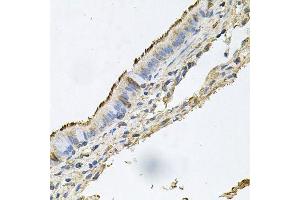 Immunohistochemistry of paraffin-embedded human trachea using DSG1 antibody. (Desmoglein 1 抗体  (AA 800-1049))