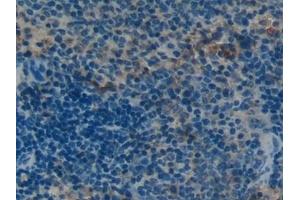Immunohistochemistry (IHC) image for anti-Osteocalcin (BGLAP) (AA 14-95) antibody (ABIN7431830)