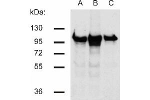 Western blotting analysis of beta-catenin in murine 3T3 (A), C57 (B) and KW1 (C) cell lines using antibody. (beta Catenin 抗体)
