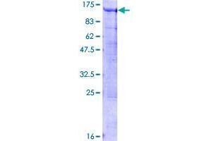 BCAS3 Protein (AA 1-913) (GST tag)