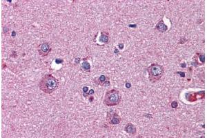Human Brain, Cortex: Formalin-Fixed, Paraffin-Embedded (FFPE) (Netrin G2 抗体  (AA 21-120))