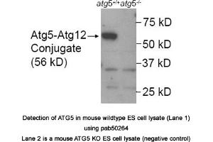 Image no. 1 for anti-ATG5 Autophagy Related 5 (ATG5) (AA 1-50), (N-Term) antibody (ABIN363573) (ATG5 抗体  (N-Term))