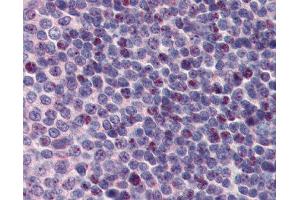 Anti-PCBP1 Antibody IHC staining of human spleen. (PCBP1 抗体  (Middle Region))