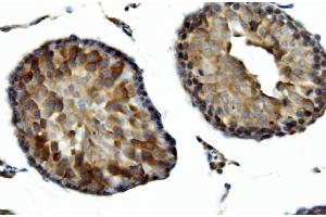 IHC analysis of DNAJA2 using anti-DNAJA2 antibody (ABIN7598991).
