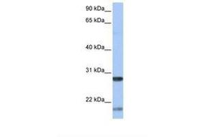 Image no. 1 for anti-Brain-Derived Neurotrophic Factor (BDNF) (AA 146-195) antibody (ABIN6738014) (BDNF 抗体  (AA 146-195))