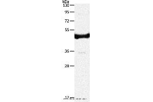 Western blot analysis of 293T cell, using IL11RA Polyclonal Antibody at dilution of 1:350 (IL11RA 抗体)