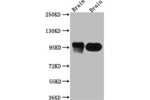 Western Blot Positive WB detected in: Rat Brain whole cell lysate, Mouse Brain whole cell lysate All lanes: PSD95 antibody at 1:1000 Secondary Goat polyclonal to rabbit IgG at 1/50000 dilution Predicted band size: 81, 86, 81 kDa Observed band size: 95 kDa (Recombinant DLG4 抗体)