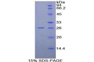 SDS-PAGE analysis of Human Cyclophilin D Protein. (PPID 蛋白)