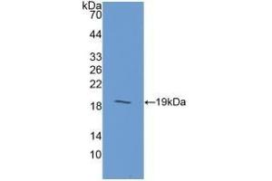 Detection of Recombinant GIP, Human using Polyclonal Antibody to Gastric Inhibitory Polypeptide (GIP) (GIP 抗体  (AA 22-153))