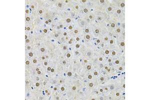 Immunohistochemistry of paraffin-embedded rat liver using SQSTM1 Antibody. (SQSTM1 抗体)