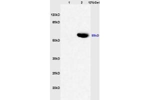 Lane 1: rat liver lysates Lane 2: human colon carcinoma lysates probed with Anti CYP3A4 Polyclonal Antibody, Unconjugated (ABIN733793) at 1:200 in 4 °C. (CYP3A4 抗体  (AA 18-120))