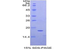SDS-PAGE analysis of Human TAF13 Protein. (TAF13 蛋白)