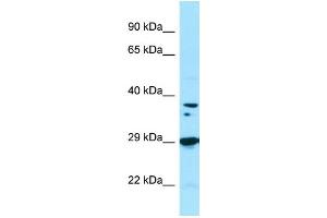 WB Suggested Anti-PPP1CB Antibody Titration: 1. (PPP1CB 抗体  (C-Term))