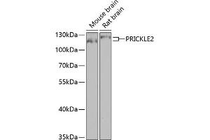 Western blot analysis of extracts of various cell lines, using PRICKLE2 antibody (ABIN6133166, ABIN6146162, ABIN6146163 and ABIN6224046) at 1:1000 dilution. (PRICKLE2 抗体  (AA 615-844))