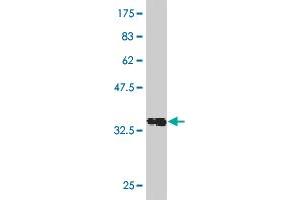 Western Blot detection against Immunogen (36. (Recoverin 抗体  (AA 101-199))
