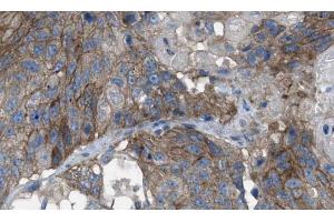 ABIN6269074 at 1/100 staining human breast tissues sections by IHC-P.