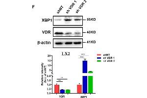 Western Blotting (WB) image for anti-Vitamin D Receptor (VDR) (AA 1-300) antibody (ABIN3023181)