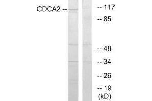 Western blot analysis of extracts from 293 cells, using CDCA2 antibody. (CDCA2 抗体  (C-Term))