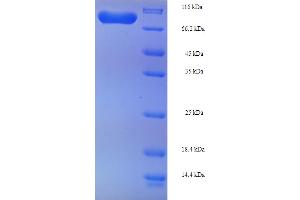 SDS-PAGE (SDS) image for Phosphoglucomutase 1 (PGM1) (AA 1-562), (full length) protein (His-SUMO Tag) (ABIN5710085)