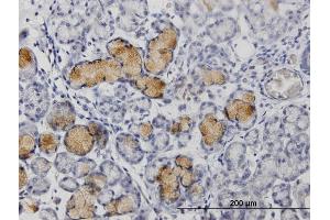 Immunoperoxidase of purified MaxPab rabbit antibody to MMP1 on formalin-fixed paraffin-embedded human colon. (MMP1 抗体  (AA 1-469))