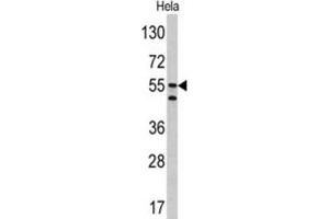 Western Blotting (WB) image for anti-Carbonic Anhydrase IX (CA9) antibody (ABIN3002202) (CA9 抗体)