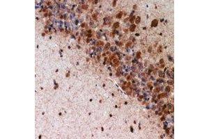 Immunohistochemical analysis of K Cadherin staining in mouse brain formalin fixed paraffin embedded tissue section. (CDH6 抗体)