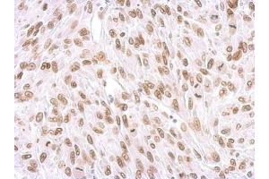 IHC-P Image Lamin A + C antibody detects Lamin A + C protein at membrane on U87 xenograft by immunohistochemical analysis.