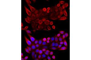 Immunofluorescence (IF) image for anti-Voltage-Dependent Anion Channel 3 (VDAC3) (AA 1-283) antibody (ABIN6150077)