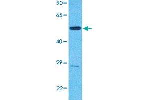 Western Blot analysis of human 786-O cell lysate with IKZF3 polyclonal antibody  at 1 ug/mL working concentration. (IKZF3 抗体  (N-Term))