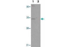 Western blot analysis of SLC39A3 in mouse lung tissue lysate with SLC39A3 polyclonal antibody  at 1 ug/mL in (1) the absence and (2) the presence of blocking peptide. (SLC39A3 抗体  (Internal Region))