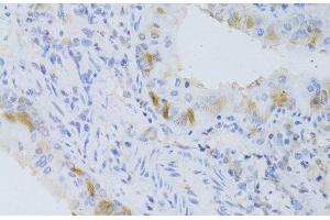 Immunohistochemistry of paraffin-embedded Mouse lung using CYP2C9 Polyclonal Antibody at dilution of 1:100 (40x lens). (CYP2C9 抗体)