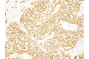 anti-PDZ-RhoGEF (AA 125-175) antibody