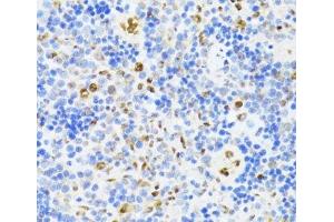 Immunohistochemistry (Paraffin-embedded Sections) (IHC (p)) image for anti-DEAD (Asp-Glu-Ala-Asp) Box Polypeptide 39B (DDX39B) antibody (ABIN7264385)