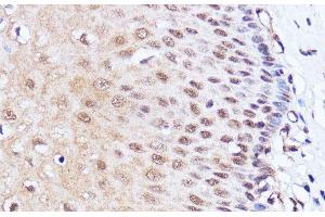 Immunohistochemistry of paraffin-embedded Human esophageal using BRD4 Polyclonal Antibody at dilution of 1:100 (40x lens). (BRD4 抗体)