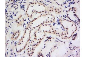 Formalin-fixed and paraffin embedded human kidney labeled with Anti-Dymeclin Polyclonal Antibody, Unconjugated  at 1:200 followed by conjugation to the secondary antibody and DAB staining. (Dymeclin 抗体  (AA 151-250))