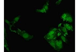 Immunofluorescent analysis of Hela cells using ABIN7161975 at dilution of 1:100 and Alexa Fluor 488-congugated AffiniPure Goat Anti-Rabbit IgG(H+L) (NOL4L (AA 101-300) 抗体)