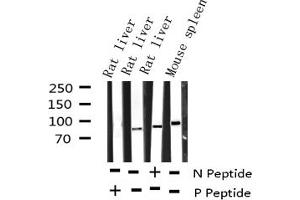 Western blot analysis of Phospho-STAT5A (Tyr694) expression in various lysates (STAT5A 抗体  (pTyr694))